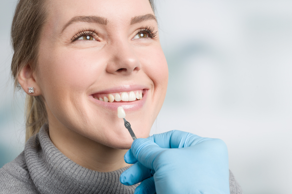 Bonding vs. Veneers: What’s the Difference?
