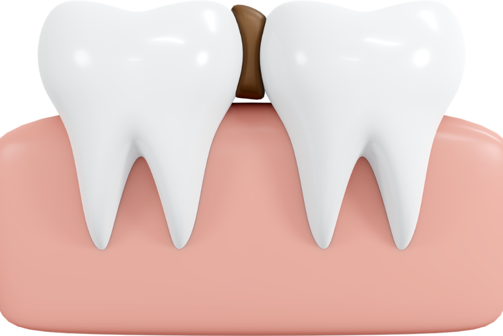 Fixing Gaps Between Teeth: Your Treatment Options